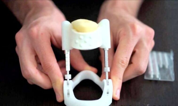 Extender for penis enlargement
